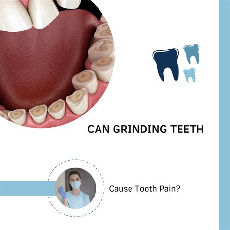 Can Grinding Teeth Cause Tooth Pain Dental Pickup