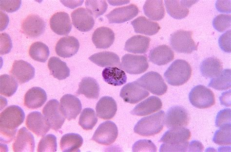 Kostenlose Bild Mikrophotographie Plasmodium Malariae Makrogametozyte