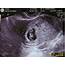Ruthiess Journal 8 Weeks Ultrasound Scan Photos