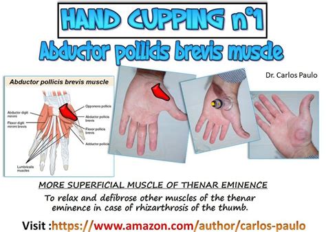 Hand Cupping N°1 Cupping Massage Deep Tissue Massage Massage Therapy