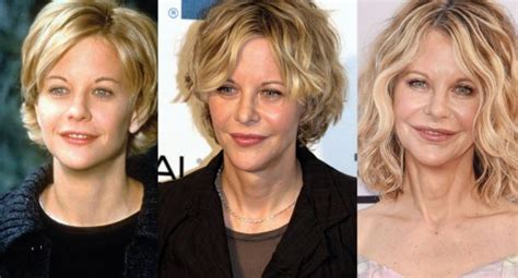 Meg Ryan Plastic Surgery Before And After Pictures 2024