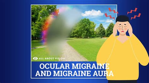 Ocular Migraines Explained Youtube