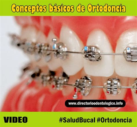 Infopaciente Conceptos Básicos De Ortodoncia Directorio Odontológico