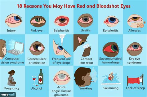 Top Treatments For Red Eyes