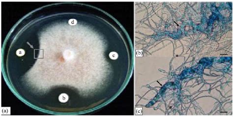 Antagonistic Effects Of Streptomyces Sp Srm1 On Colletotrichum Musae