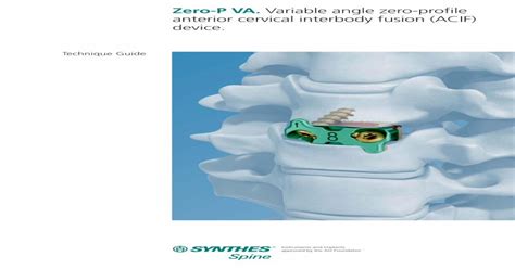 Zero P Va Variable Angle Zero Profile Anterior Cervical Synthesvo