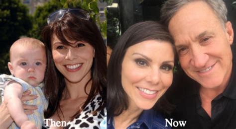 Who is dr dubrow on now that's botched? Heather Dubrow Plastic Surgery Before and After Photos ...