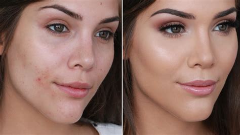 How To Cover A Pimple With Foundation Distinct Blogs Photogallery