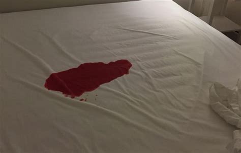 Removing blood stains can be frustrating. How To Remove Blood Stains From A Mattress - Clean Home Guide