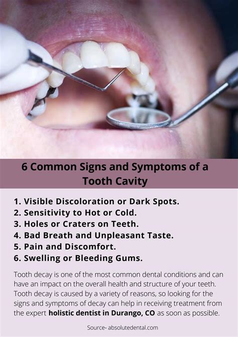 6 Common Signs And Symptoms Of A Tooth Cavity By Anthonyalfonso Issuu