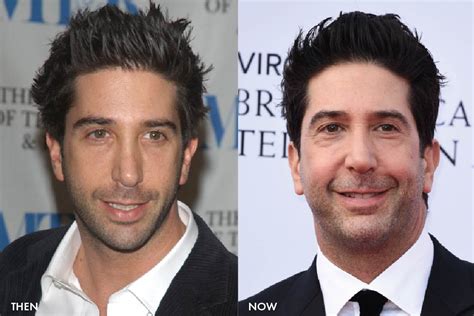 David Schwimmer Ross Victim Of False Botox And Fillers Newme
