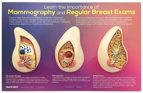 Breast Cancer Awareness Facts And Teaching Tools Health Edco