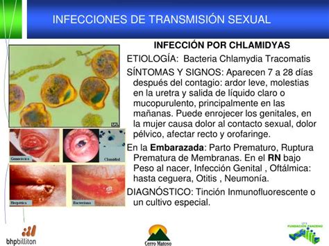 Ppt Infecciones De De Transmision Sexual Powerpoint Presentation Id 6190618