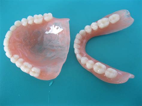 Dento Care Dental Clinics Sunflex Complete Denture