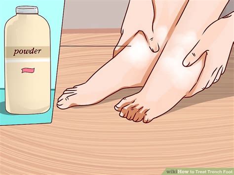 How To Treat Trench Foot 11 Steps With Pictures Wikihow