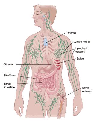 Most common bone marrow diseases leukemia. Lymph Nodes and Cancer