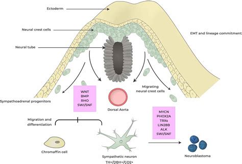 Types Of Neuroblastoma On Arm