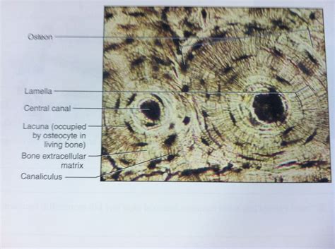 Compact bone, microscopically, is made of numerous osteons, whereas spongy bone is composed of sheets of lamellar bone and does not contain osteons. Osteon slide tissue histology | I'm a nurse | Pinterest