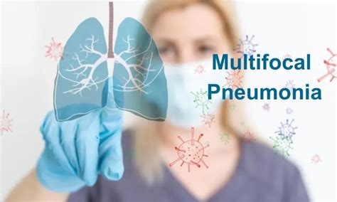 Multifocal Pneumonia Causes Symptoms Diagnosis And Treatment Soflacil