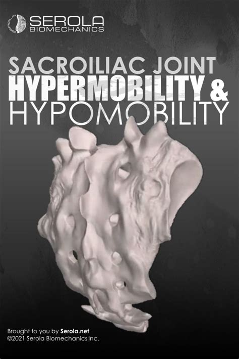 Hypermobility Hypomobility Serola Hypermobility Sacroiliac Joint