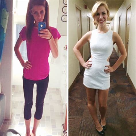120 Before And After Pics Of People Who Defeated Anorexia Bored Panda