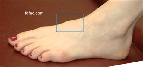 Often these lumps are actually swollen lymph nodes. Foot Pain - Tendinitis?: Triathlon Forum: Slowtwitch Forums