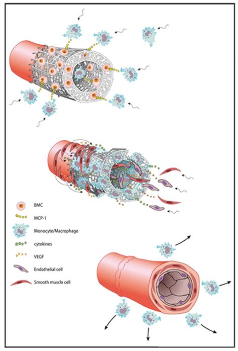 Vascular Tissue Engineering Toshiharu Shinoka 5 Updates Research