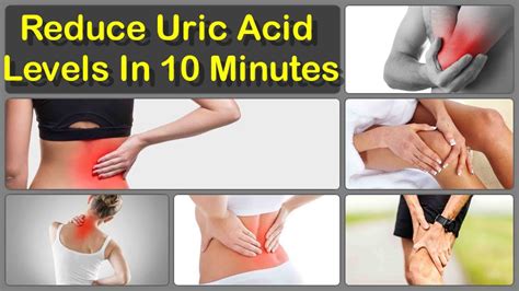 What Should I Do To Reduce My Uric Acid Level And How To Decrease Uric Acid Permanently Youtube