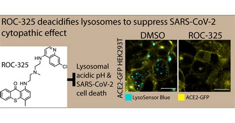 The Sars Cov 2 Cytopathic Effect Is Blocked By Lysosome Alkalizing