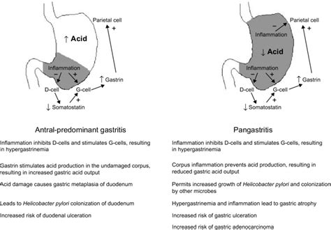 The Effect Of Gastritis Pattern On Gastric Acid Production And