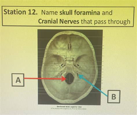 Solved Station 12 Name Skull Foramina And Cranial Nerves That Pass