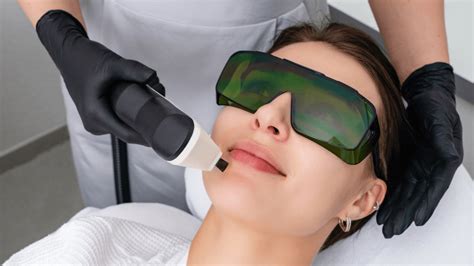 Excel V Laser Gensis Advanced Laser Treatments Toronto Dermatology Centre