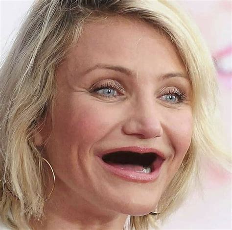 Celebrity Without Teeth Gag