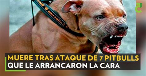 Muere Tras Ataque De 7 Pitbulls Que Le Arrancaron La Cara