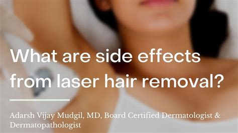 What Are Side Effects From Laser Hair Removal Wikihow Asks A