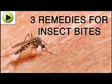 Home Remedies Wasp Stings Swelling