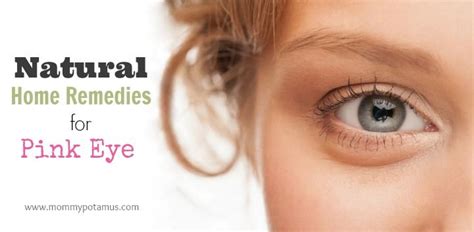 5 Natural Remedies For Pink Eye Pinkeye Remedies Pink Eyes Puffy Eyes