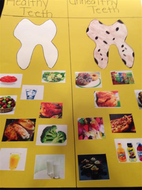 Healthy Teeth Versus Unhealthy Teeth I Made This Poster Board For