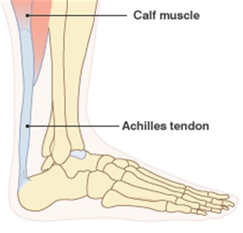 Place your hands on the floor in front of you. BBC News - Q&A: Torn Achilles tendon