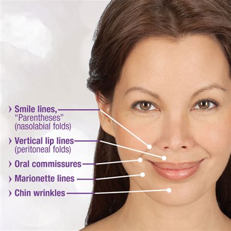 Smile Lines — Advanced Dermatology