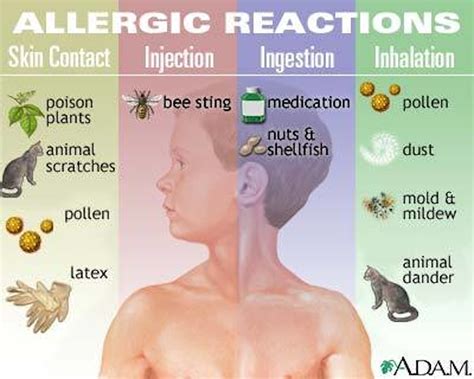 Anaphylaxis What You Need To Know About Life Or Death Allergic Reactions Officer