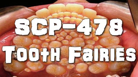 Scp 478 Tooth Fairies Object Class Euclid Body Horror Scp Season