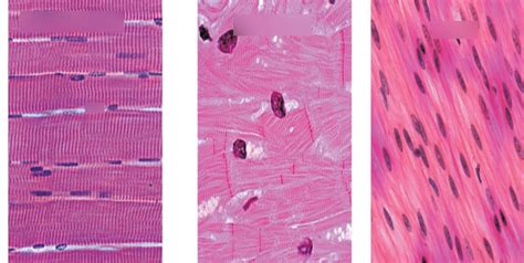 Muscle Tissue Microscopic Slides Diagram Quizlet