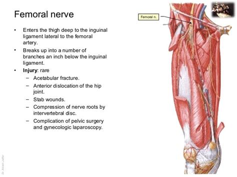 Applied Anatomy Femoral Nerve Injury