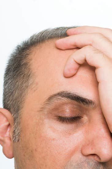 5 Early Signs Youre Going Bald Fight Hair Loss Immediately