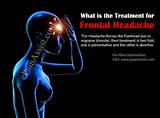 Frontal Headache Treatment Photos