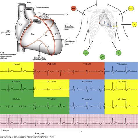 Coronary Arteries Positioning Of Ecg Leads Corresponding 12 Lead Ecg