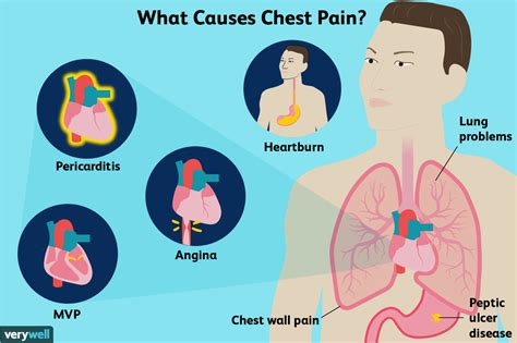 How Do You Tell If Chest Pain Is A Serious Emergency