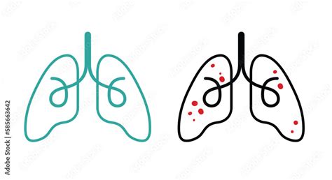 Vecteur Stock Healthy Lungs And Lungs Disease Minimalist Lineart
