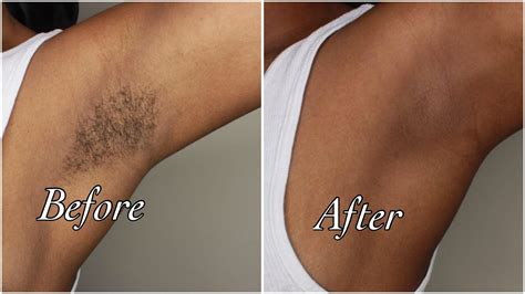 39 Best Pictures How To Wax Armpit Hair - Underarm Waxing: The Good